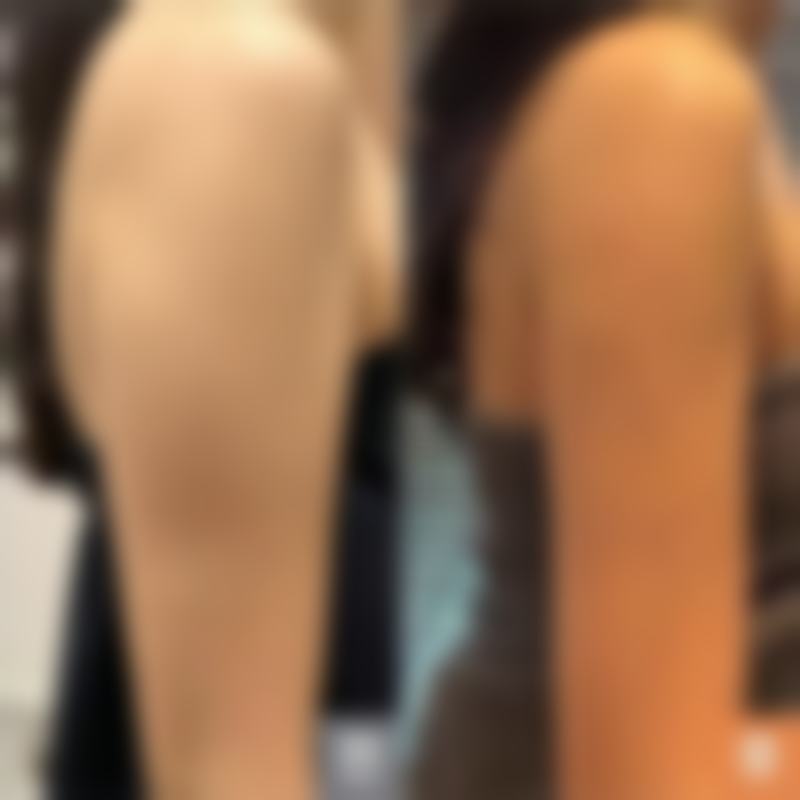 北京柏丽整形医疗美容医院口碑如何？