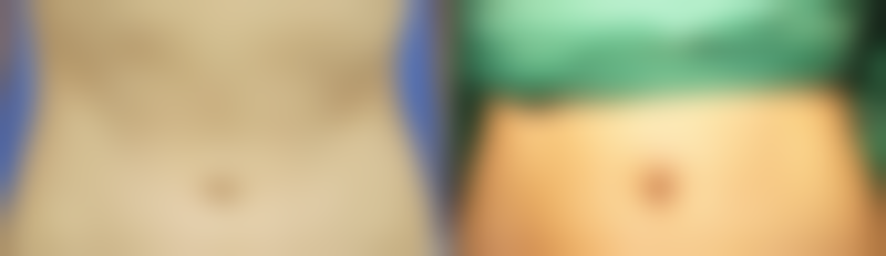 北京柏丽整形医疗美容医院硬件设备精良！