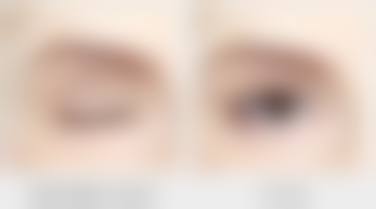 陕西汉中谭医生整形美容地址