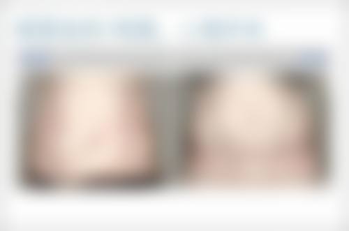 总结——郑州芳华医疗美容门诊部怎么样？