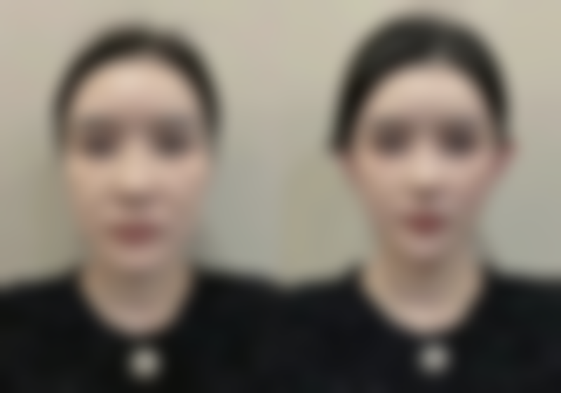 成都驻颜美容整形医院医院技术好不好？