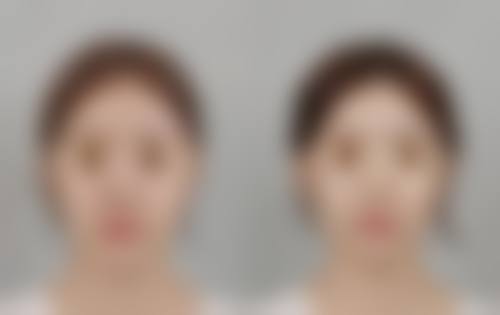 总结——江门市蓬江区俏姿美容怎么样？