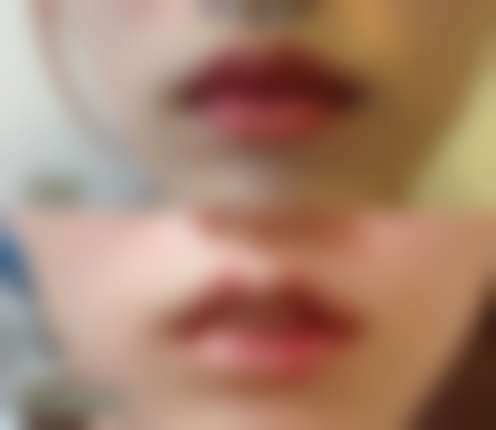 丽水樊承红医疗美容诊所沈月霞医生口碑评价如何？