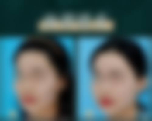 如何预约广州高尚医学美容中 心余文林医生？