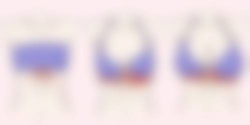 南宁美初医疗美容门诊部何胜医生口碑评价如何?