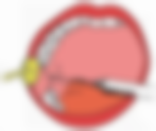 浙江温州眼视光医院整形科电话号码及预约方法