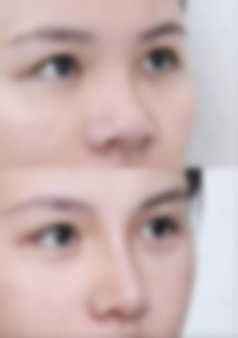 长沙美研医疗美容整形医院收费标准参考