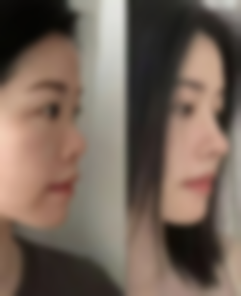 南宁美初医疗美容门诊部何胜医生技术好不好?