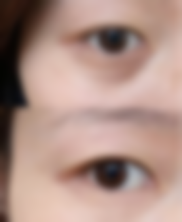 浙江温州眼视光医院整形科口碑如何？