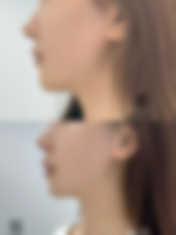 浙江温州眼视光医院整形科硬件设备精良！