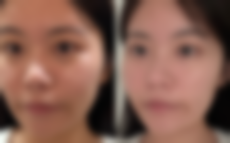 杭州新福柏整形医院硬件设备精良！