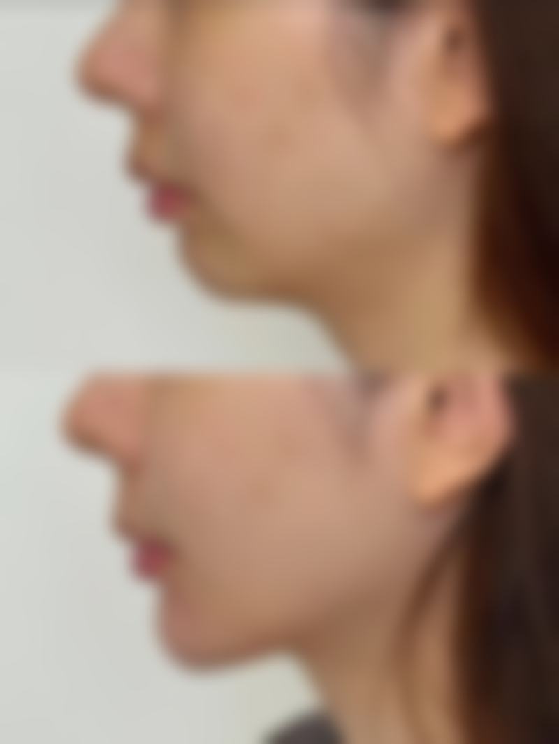 总结——南宁美初医疗美容门诊部何胜医生怎么样?