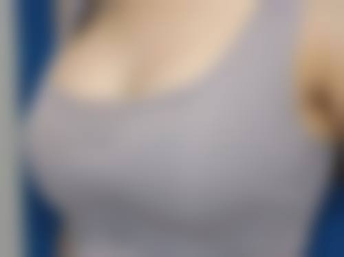 北京艾丽斯妇科医院赵美容医生技术好不好?