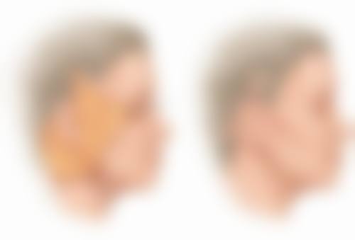 总结——哈尔滨二四二医院美容整形科怎么样？