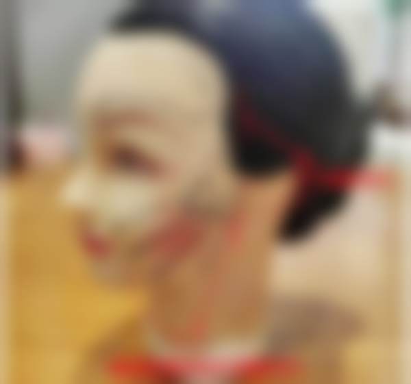 北京黄寺医疗美容门诊部王咏民隆鼻去眼袋案例效果揭秘40年医美老牌医院的变美奇迹！ 