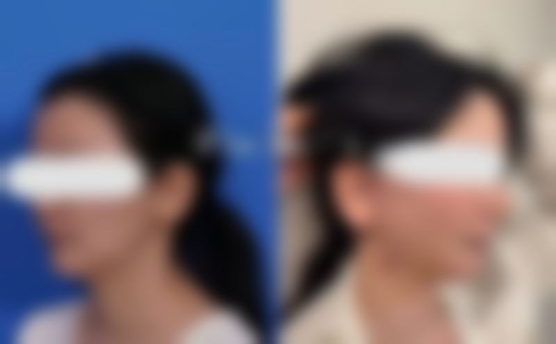 河北衡水莱茵医疗美容诊所医院技术好不好？