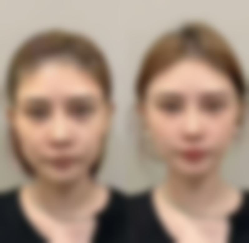 广州新海医院整形美容科收费标准参考