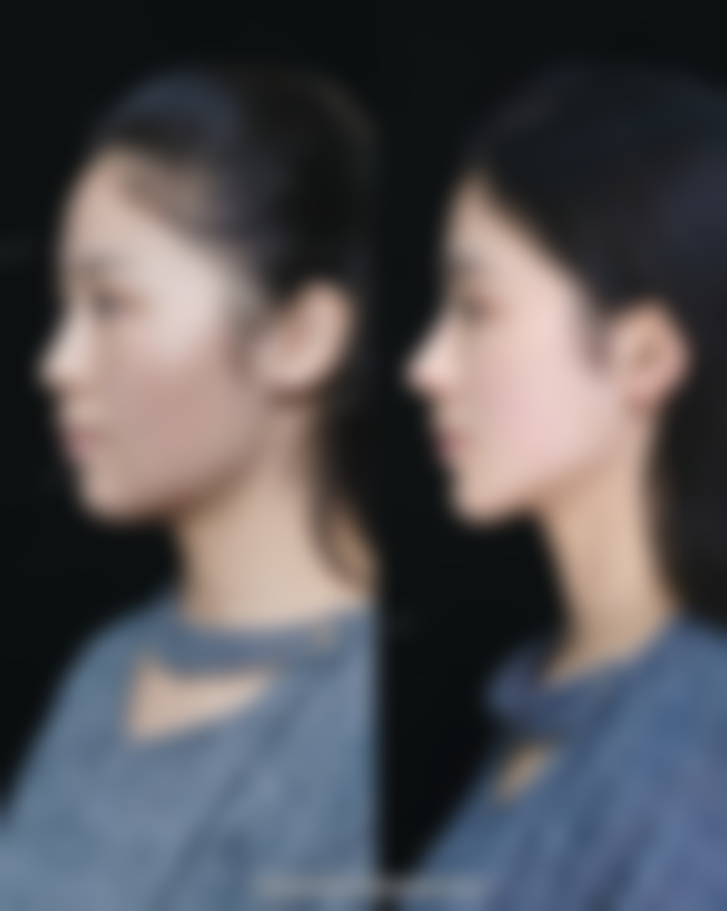 海口美兰红妆双美安信整形医院硬件设备精良！