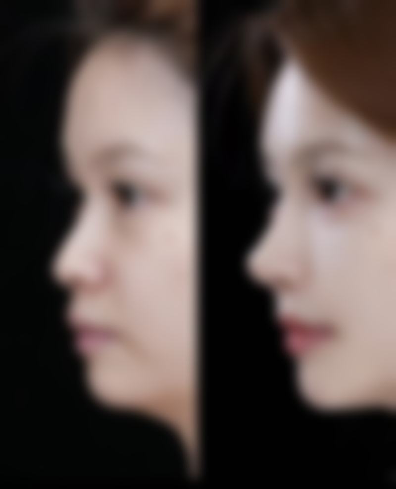 清远英德田氏整形医院电话号码及预约方法