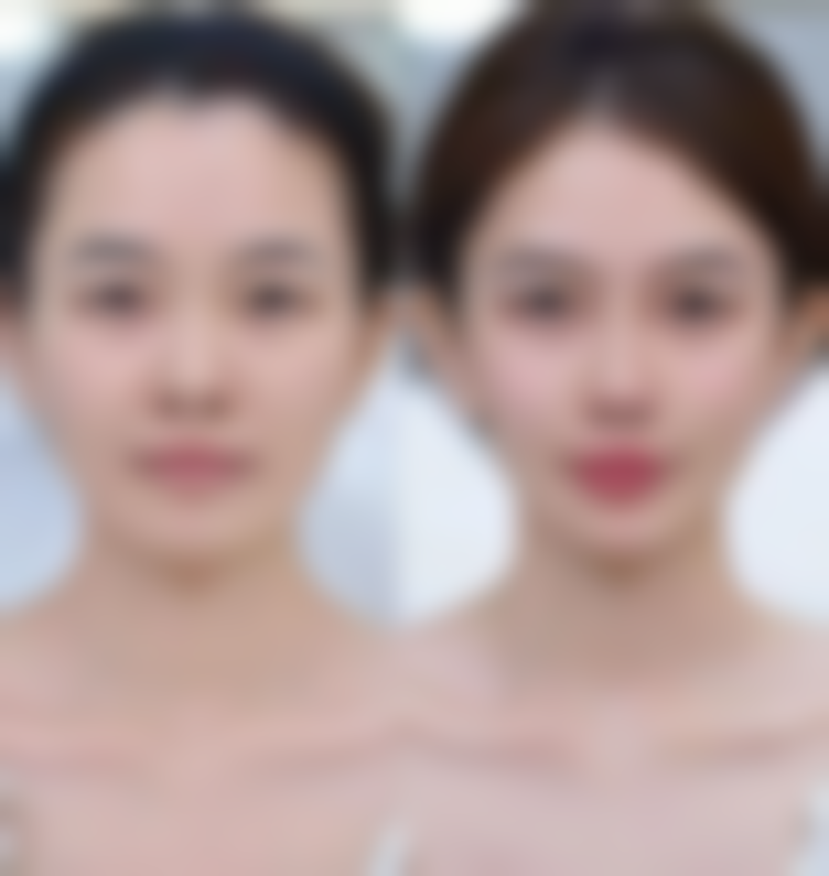 北京艾丽斯妇科医院赵美容医生挂号预约攻略