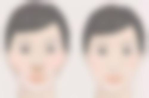 成都博莱尚美整形医院医院技术好不好？