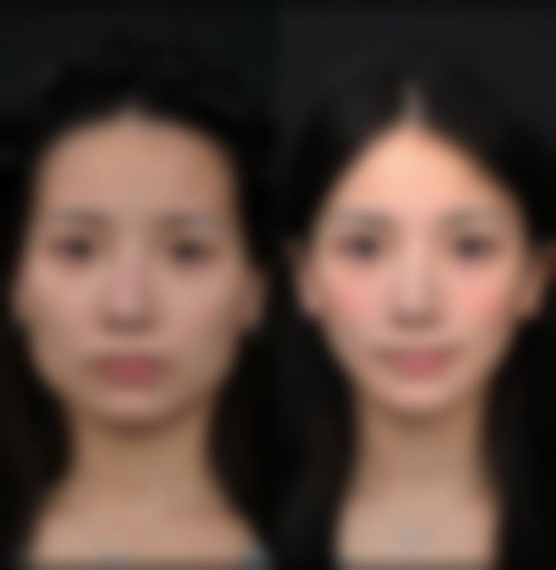 武汉茜韵医疗美容门诊部医院技术好不好？