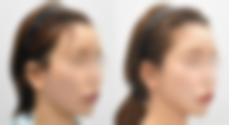 成都博莱尚美整形医院口碑如何？