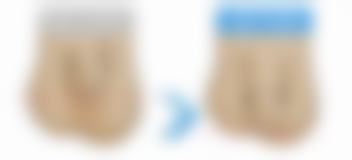 杭州蜜佑医疗美容诊所私密地址