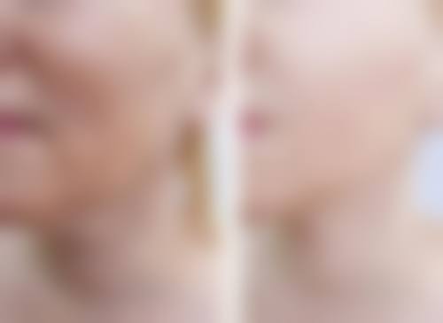 西安悦邦美医疗美容门诊部硬件设备精良！