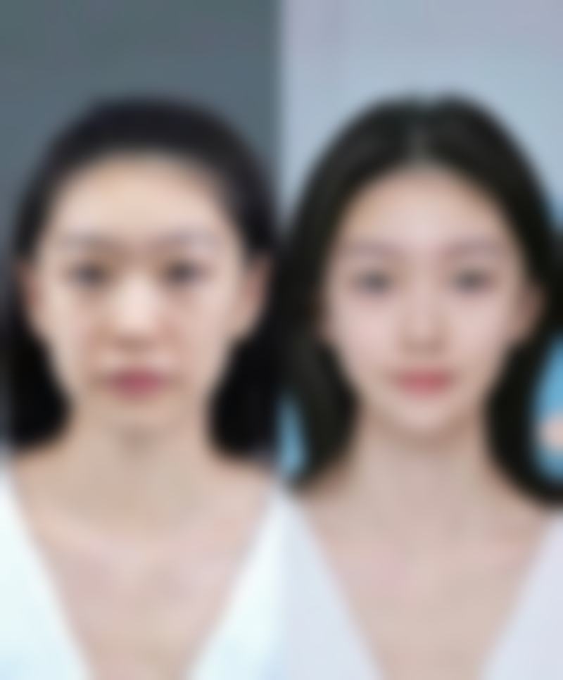 武汉斯启诺医美科普：仪器抗衰适合哪些人呢？