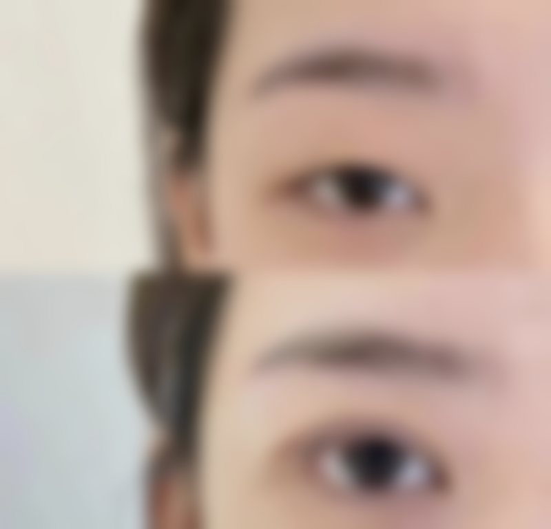 杭州蜜佑医疗美容诊所私密医院技术好不好？