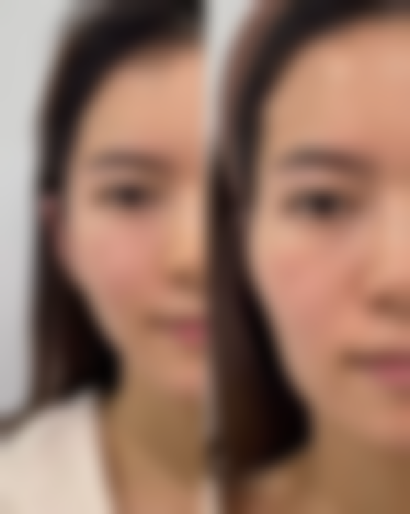 连云港时光盛美整形诊所收费标准参考