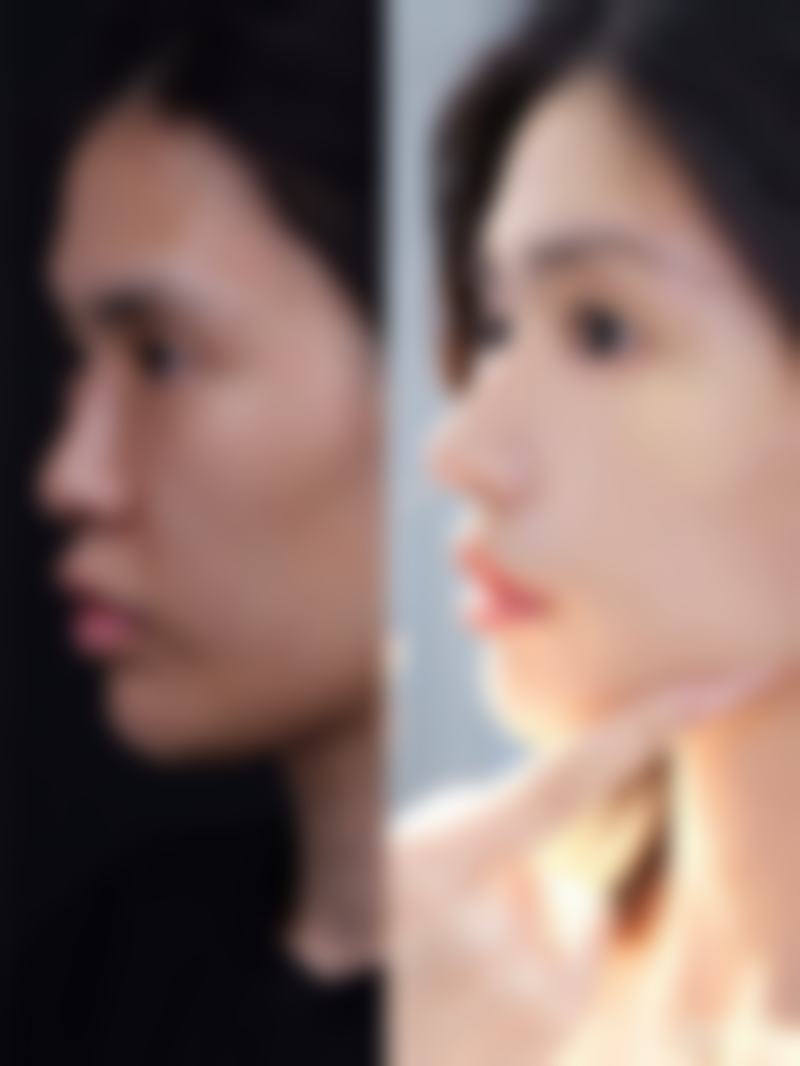 石家庄美然医疗美容医院技术好不好?