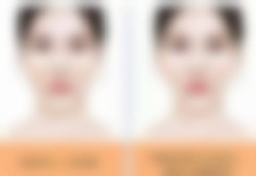 总结——合肥瑶海童颜美医疗美容门诊部怎么样？