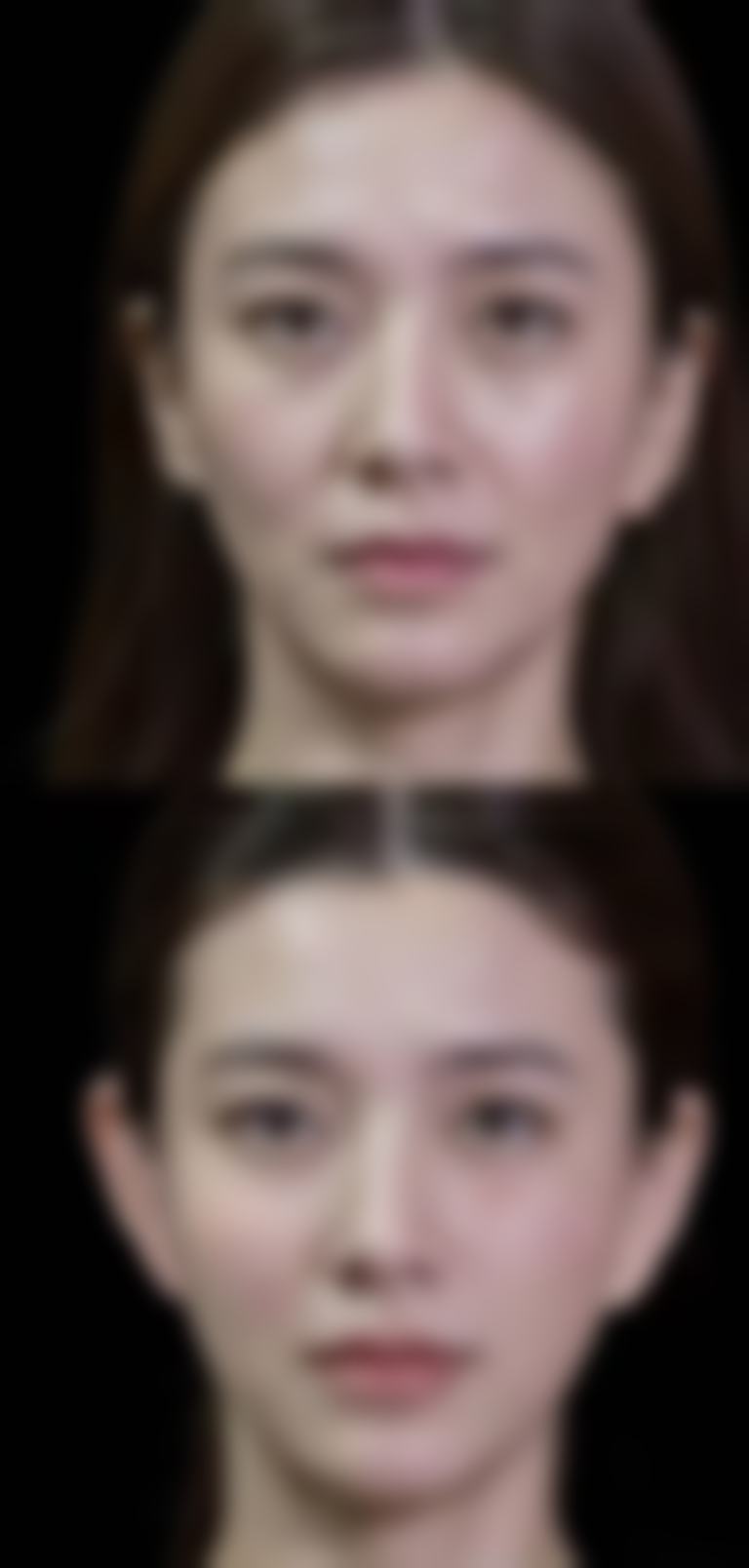 总结——秦皇岛纪辉整形美容医院怎么样？