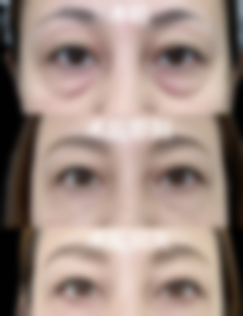 南阳爱贝尔整形医院收费标准参考