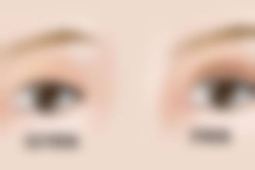 上海伯思立医疗美容门诊部徐文龙医生口碑评价如何？