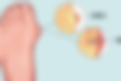 总结——泉州丰泽欧菲医疗美容门诊部叶森明医生怎么样？