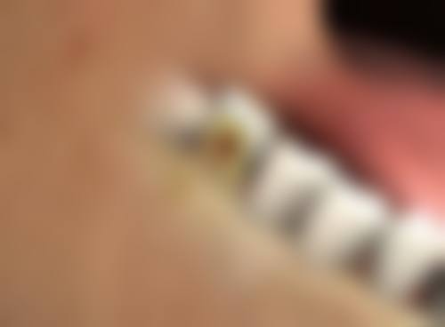 总结——重庆星荣整形外科医院林茂辉医生怎么样？