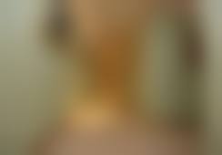 北京美莱医疗美容医院收费标准参考