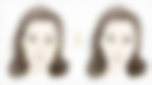 总结——中山爱思特美容医院陈伟彬医生怎么样？