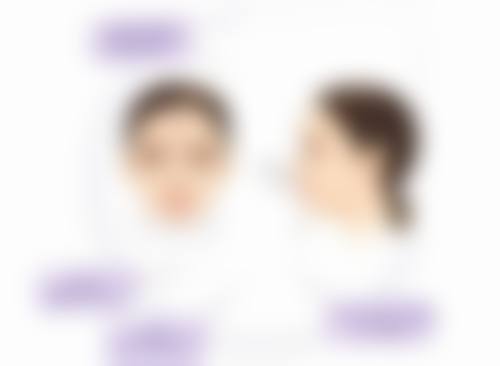 南宁美初医疗美容门诊部李世碧医生技术好不好？