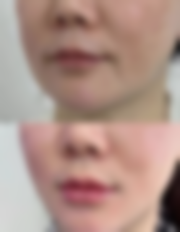 广州荔医医疗美容门诊部曾德浩医生技术好不好？