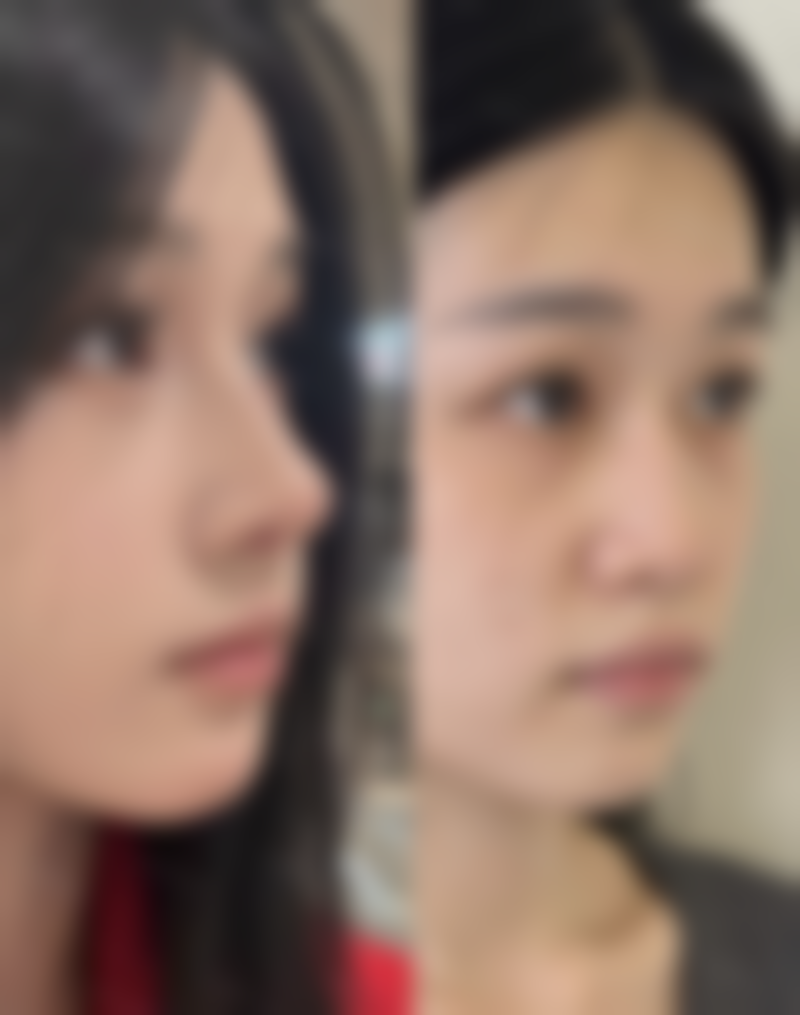 泉州丰泽欧菲医疗美容门诊部叶森明医生挂号预约攻略