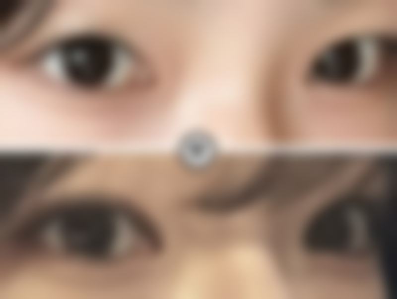 贵阳美莱医疗美容医院余升原医生技术好不好？