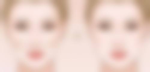 青岛媞妃整形医院医院技术好不好？