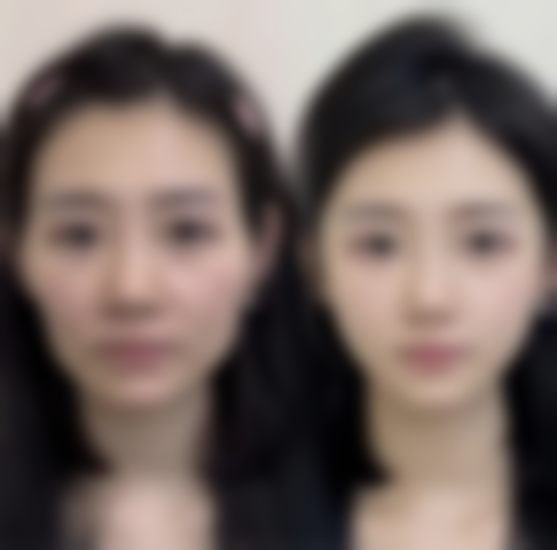 合肥光美整形医疗美容门诊部医院技术好不好？