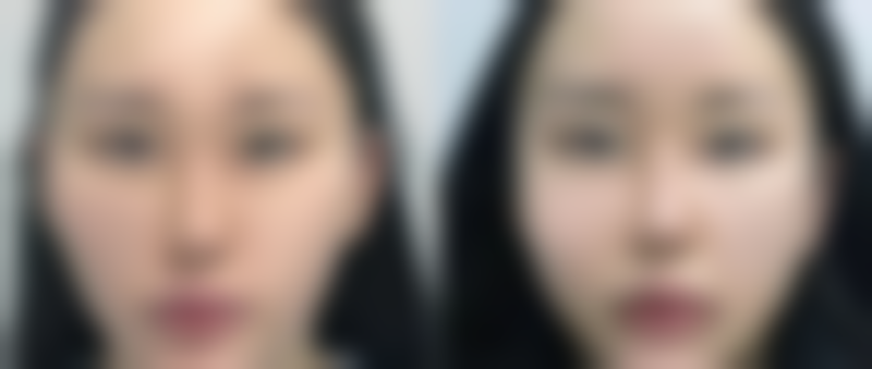 海南省皮肤病医院收费标准参考