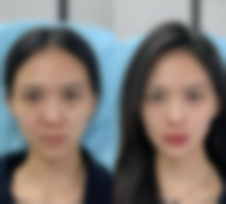 总结——合肥光美整形医疗美容门诊部怎么样？