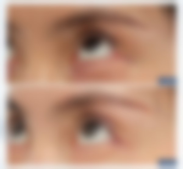 上海爱尚丽格医疗美容门诊部杜园园挂号预约攻略大揭秘！多样方式+优质服务助你轻松变美 